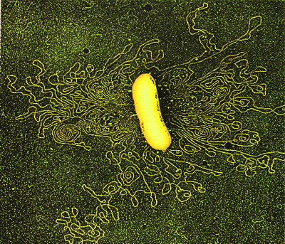 DNA Eukaryotic gene structure