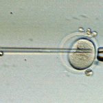 DNA cloning