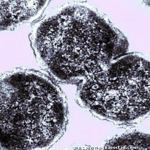 Clostridium perfringens